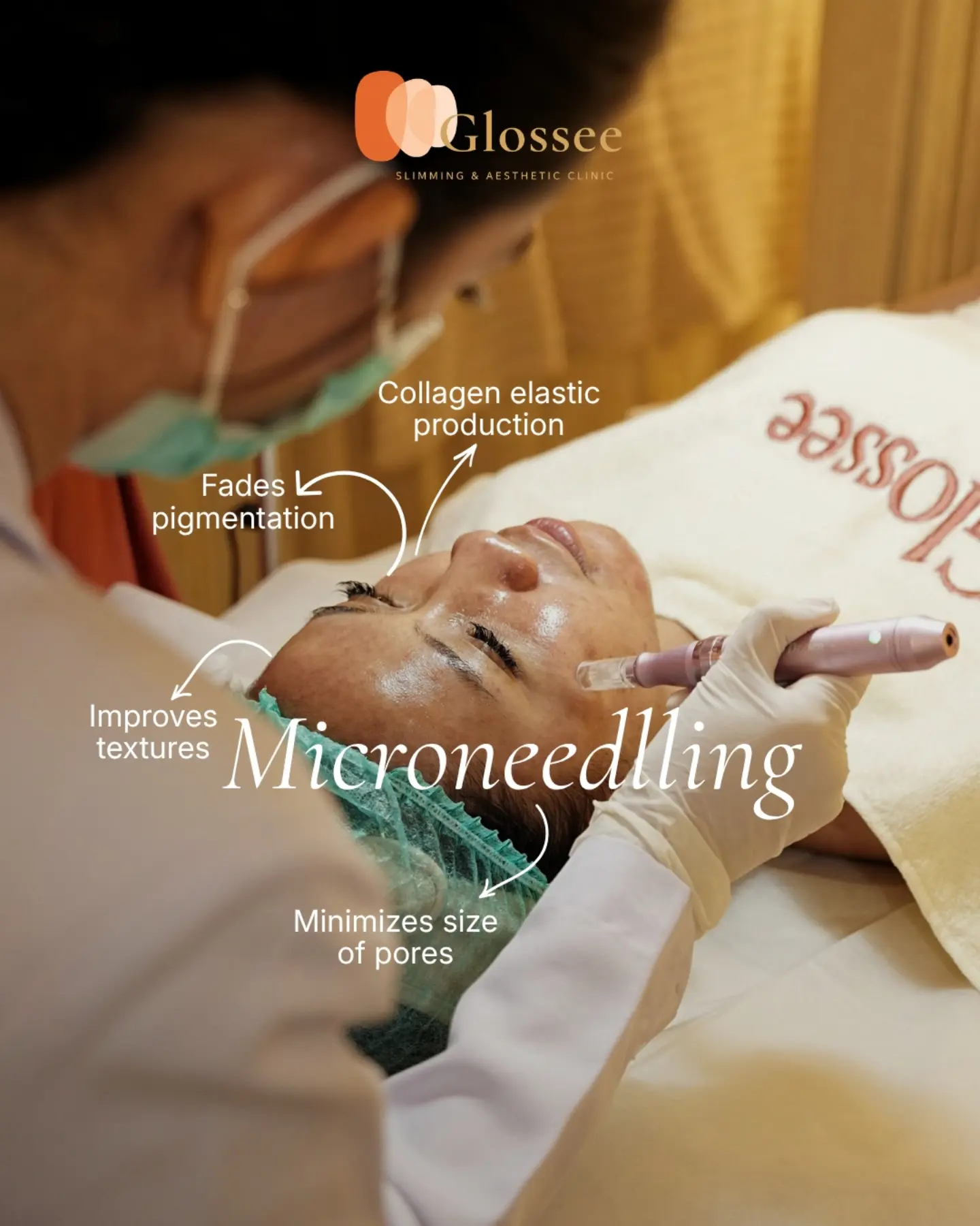 Microneedling care featured by GLOSSEE
